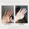 Eczema Testimonial