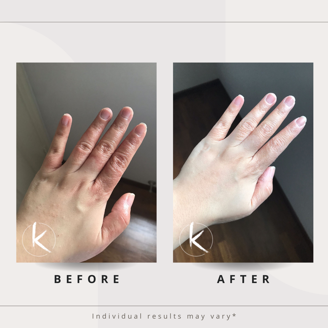 4 Eczema Testimonial